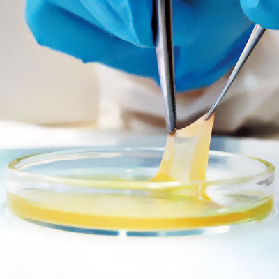 Gel PRF (platelet rich fibrin)