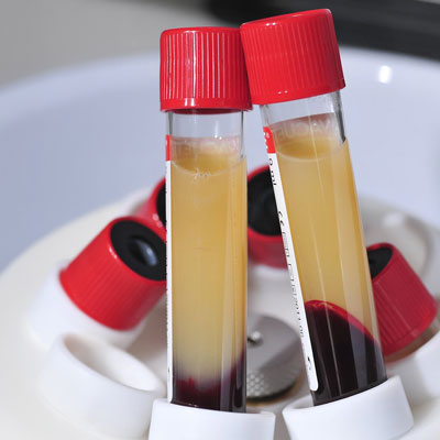 This image for Image Layouts addon