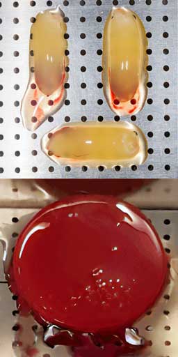 Coaguli CGF e membrana PRF